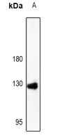 Laminin beta 3 antibody
