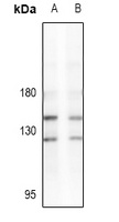 Anti-LATS2 Antibody
