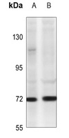 Anti-TNFAIP2 Antibody