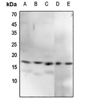 CENPA (pS7) antibody