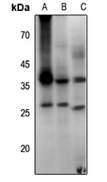 Anti-Aquaporin 2 (Phospho-S256) Antibody