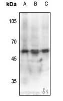Anti-MEF2C (Phospho-S387) Antibody