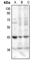SerpinB1 antibody