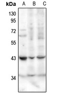 Anti-SerpinB1 Antibody