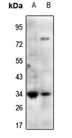 Mimecan antibody