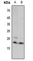 Histone H3 (MonoMethyl-K18) antibody