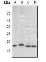 Anti-Histone H3 (TriMethyl-K79) Antibody