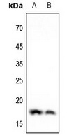 Histone H3 (DiMethyl-K4) antibody