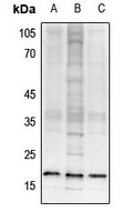 Histone H3 (TriMethyl-K26) antibody