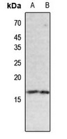 Histone H3 (Butyryl-K18) antibody