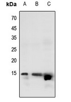 Histone H2B (Butyryl-K20) antibody
