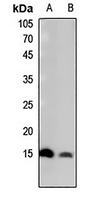 Histone H2B (Butyryl-K15) antibody