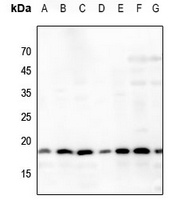 Histone H3 (AcK64) antibody