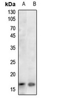 Histone H3 (AcK36) antibody