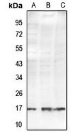Histone H2B (AcK34) antibody