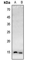 Histone H4 (AcK20) antibody