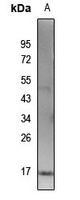 Histone H3 (AcK115) antibody