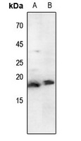 Histone H3 (AcK79) antibody