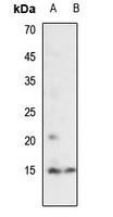 Histone H2A (AcK7) antibody