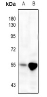 Anti-MMP3 Antibody