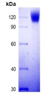 COVID-19 S1 Protein (Omicron, B.1.1.529)