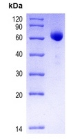 COVID-19 S Protein RBD (Omicron, BA.2)