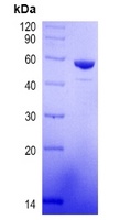 COVID-19 Nucleocapsid Protein (Omicron, B.1.1.529)