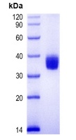 COVID-19 S Protein RBD (Omicron, B.1.1.529)