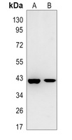G6PC1 antibody