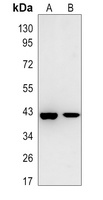 Anti-G6PC1 Antibody