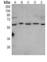 Anti-RIPK3 Antibody