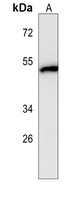 Anti-SNX6 Antibody