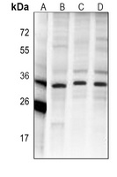 CHIP antibody