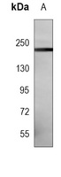 Anti-NOTCH3 Antibody