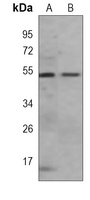 Anti-FZR1 Antibody
