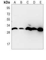 Anti-RAB23 Antibody