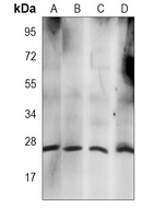 Anti-RAB21 Antibody
