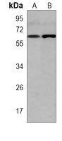 Anti-GLS2 Antibody