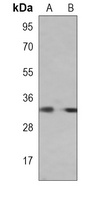 RAB20 antibody