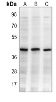 Anti-FIH-1 Antibody