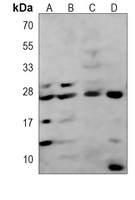 Anti-FGFR1OP2 Antibody