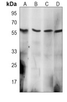 EIF2B3 antibody