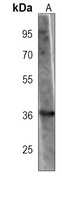 FN3K antibody