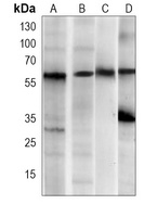 Anti-ATG5 Antibody