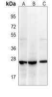 RAB1B antibody