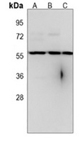 Anti-RBCK1 Antibody