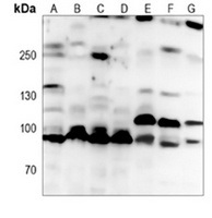 Anti-ACE2 Antibody