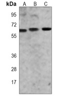 CRMP-5 antibody