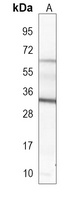 Anti-GDF15 Antibody