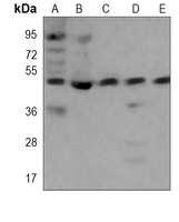 Anti-TSG101 Antibody